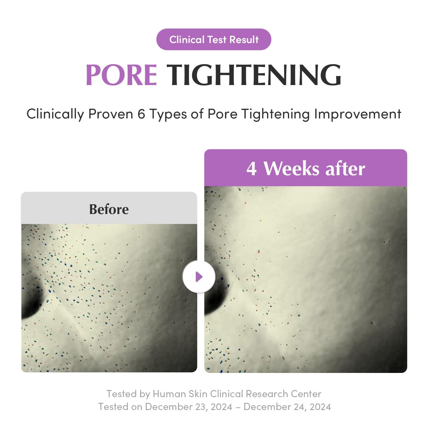 Purple Rice 3-Step Pore Care & Glass Skin Trio – Cleansing Oil, Pack Cleanser & Pore Minimizing Serum | Complete Korean Skincare for Double Cleansing, Pore Refining & Skin Prep