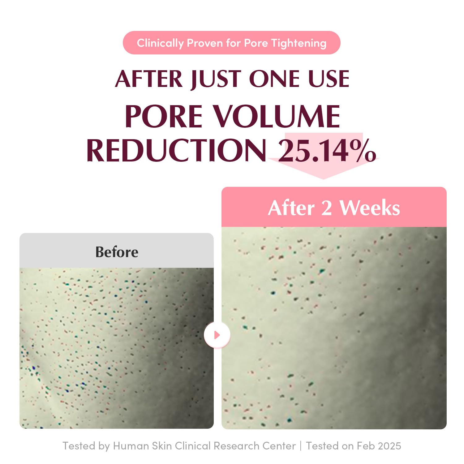 Firming & Pore Care Duo – Bakuchiol Plumping Serum & Collagen Pore-Tight Up Mask | Retinol Alternative & Vegan PDRN for Elasticity, Pore Minimizing & Smooth Skin