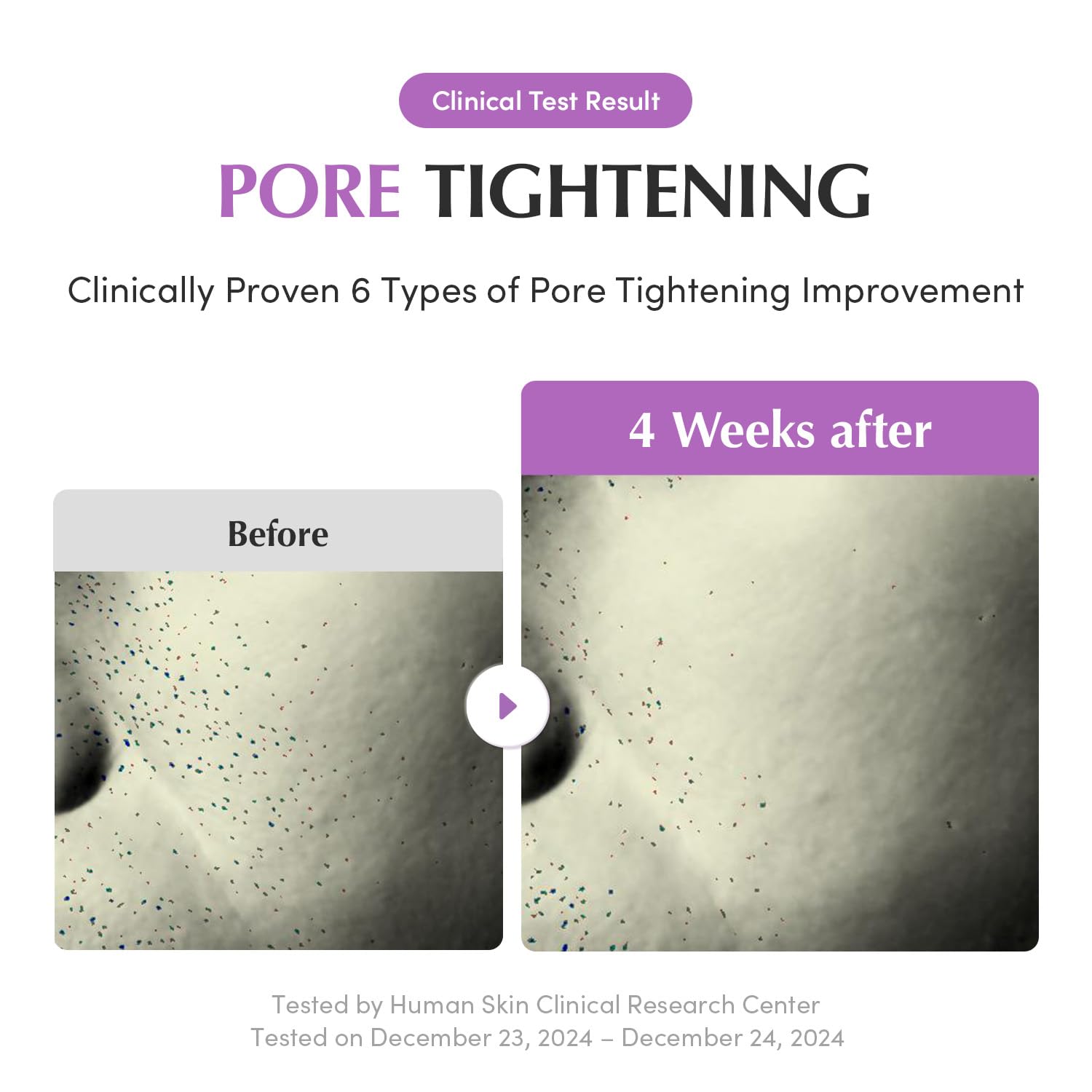 Purple Rice 3-Step Pore Care & Glass Skin Trio – Cleansing Oil, Pack Cleanser & Pore Minimizing Serum | Complete Korean Skincare for Double Cleansing, Pore Refining & Skin Prep