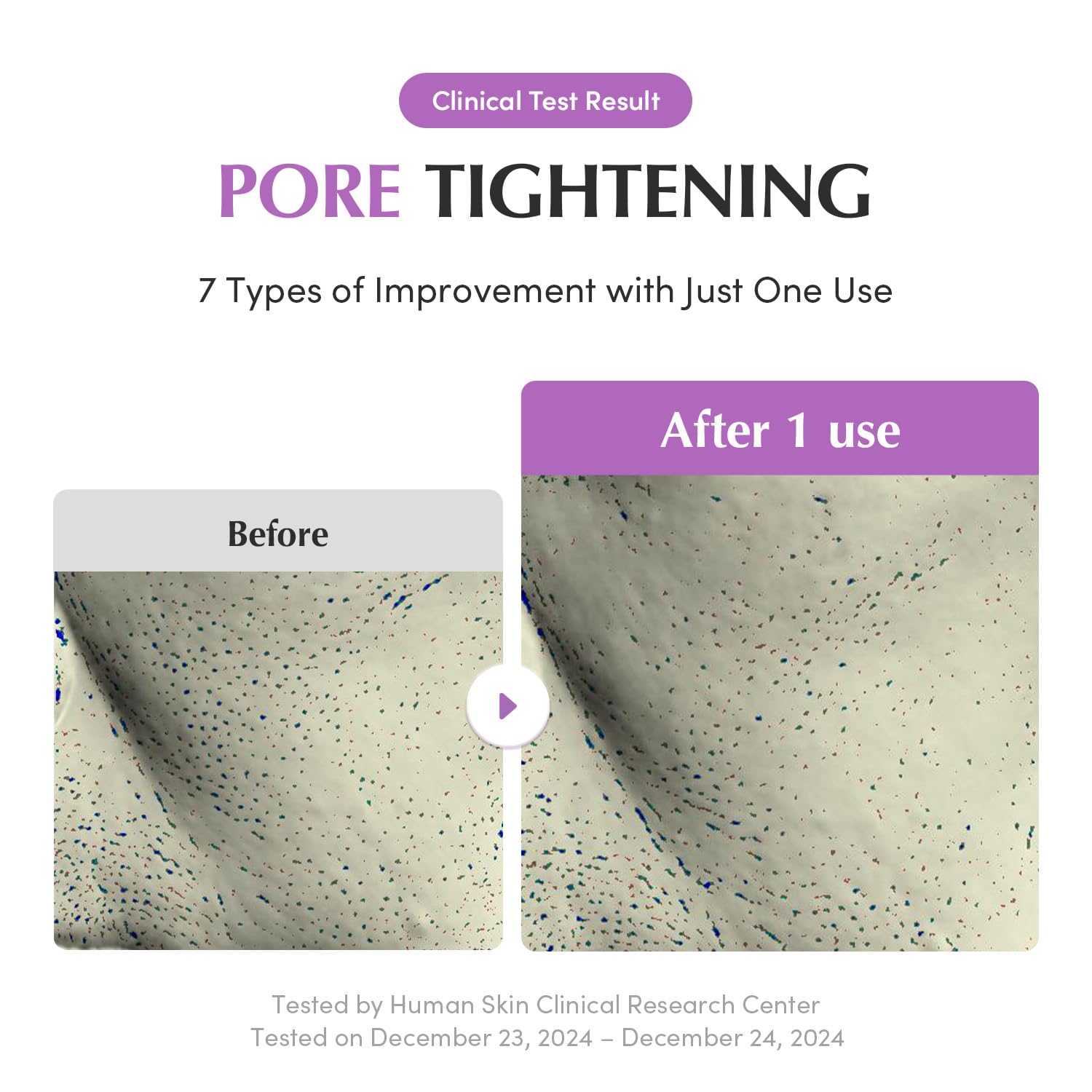 Purple Rice 3-Step Pore Care & Glass Skin Trio – Cleansing Oil, Pack Cleanser & Pore Minimizing Serum | Complete Korean Skincare for Double Cleansing, Pore Refining & Skin Prep